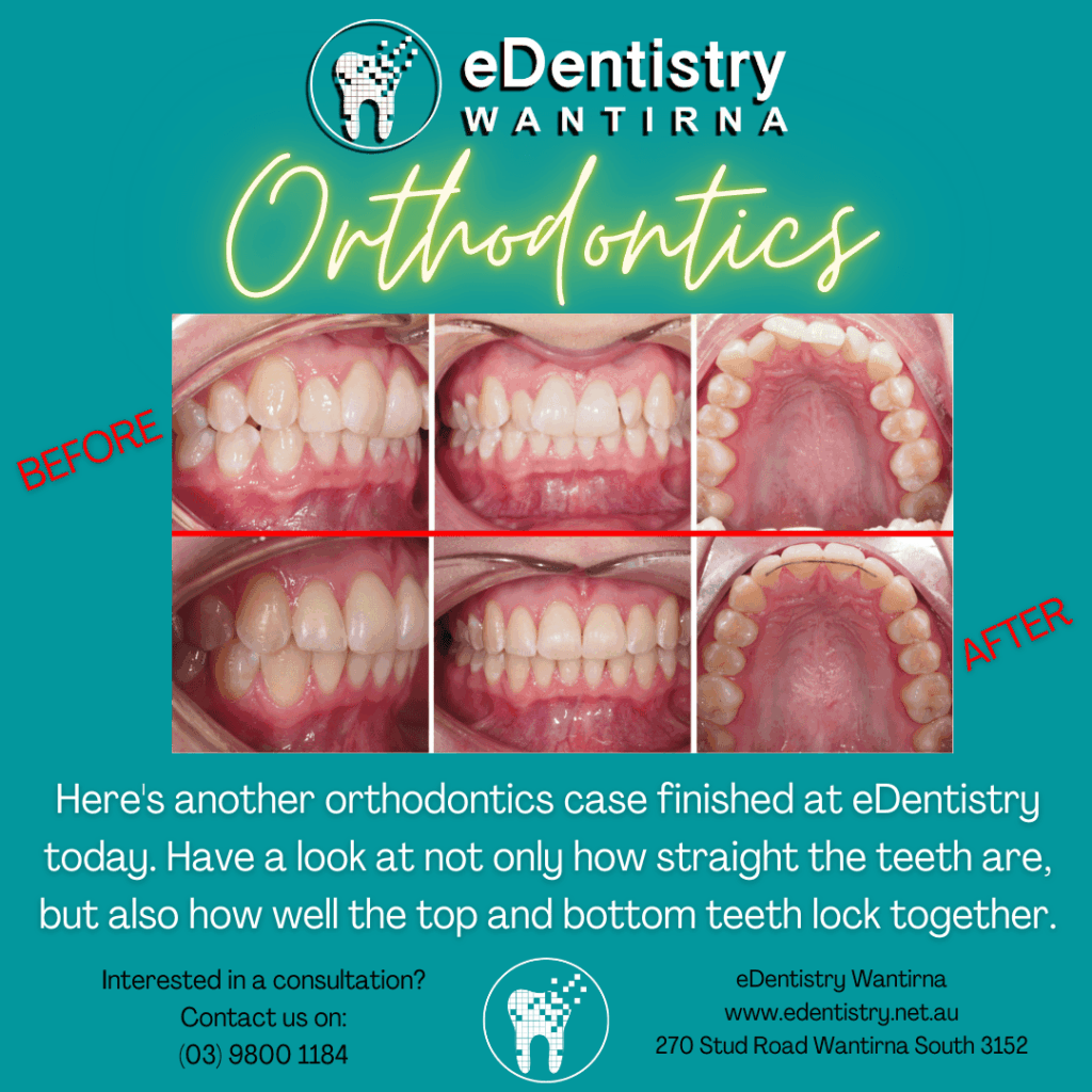Orthodontic Case Study Post eDentistry Wantirna