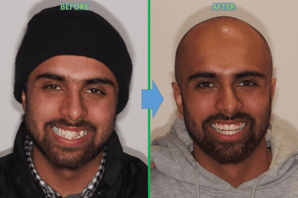 Orthodontic Case Study eDentistry Wantirna